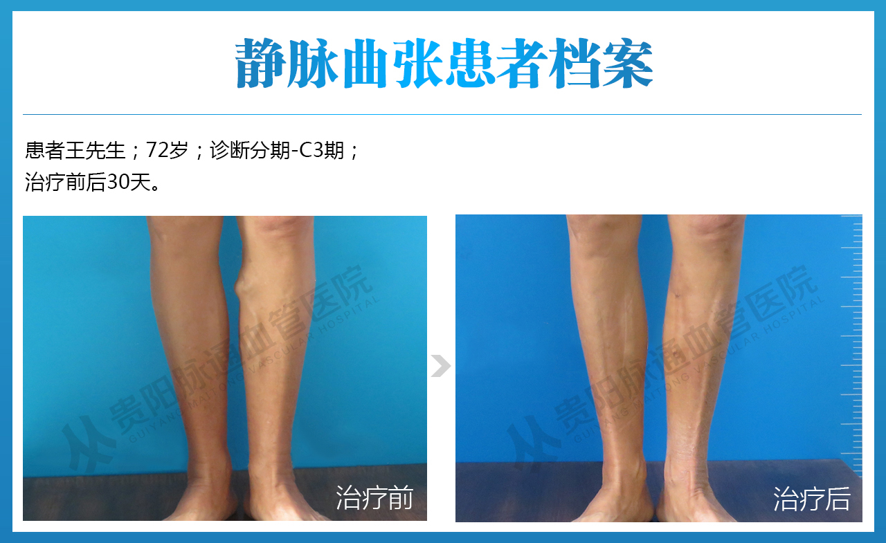 王学彬-男-72-C3