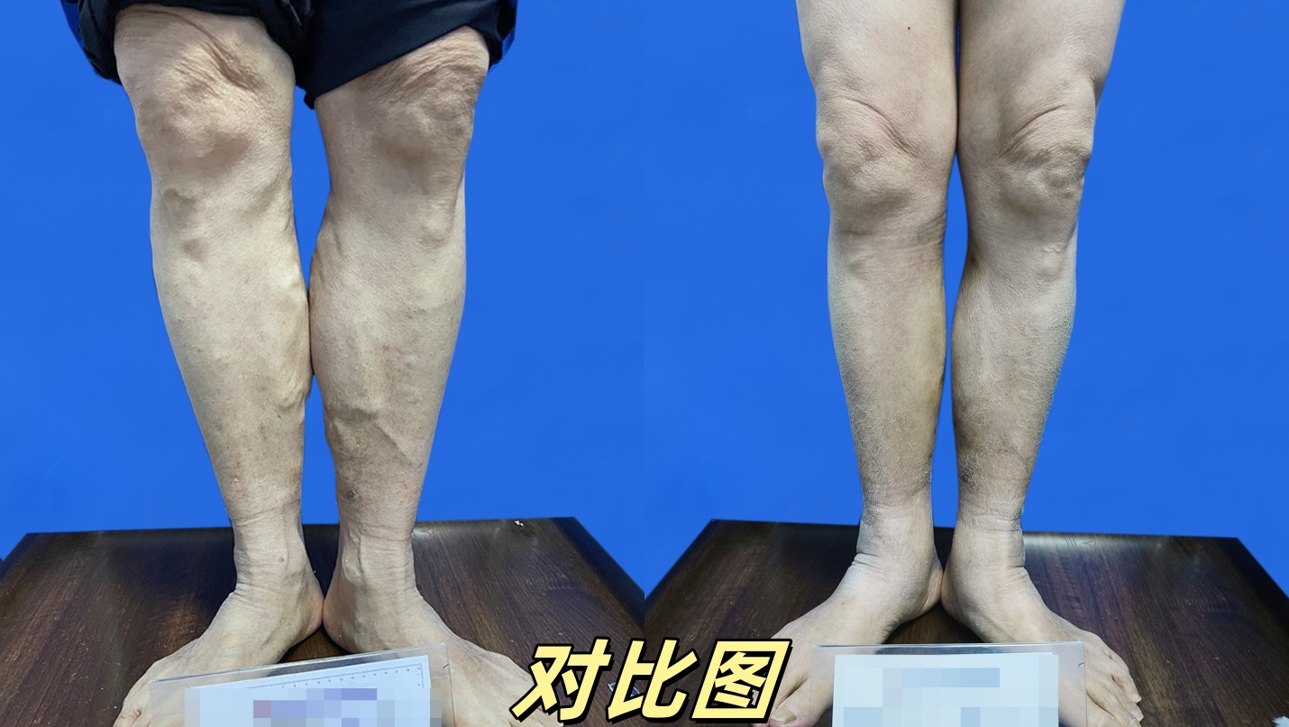 对比图10