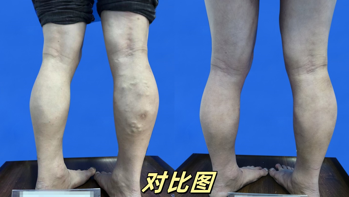 对比图06