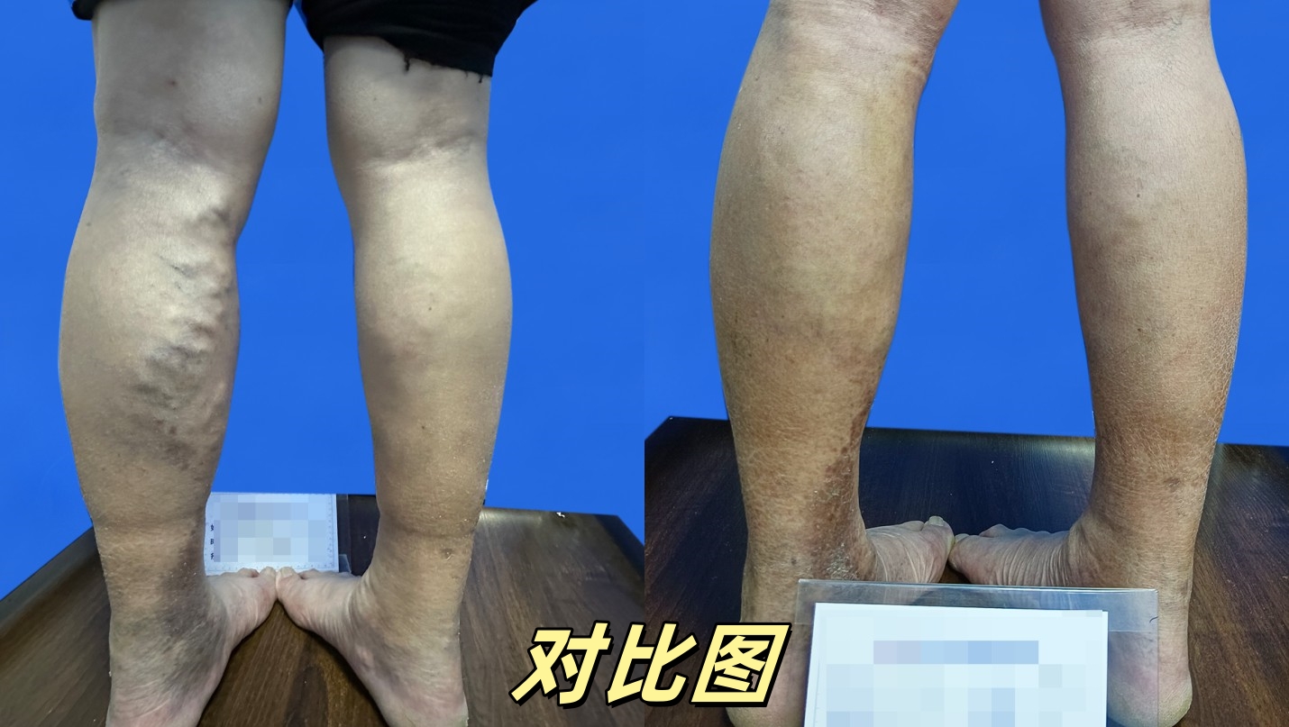 对比图09