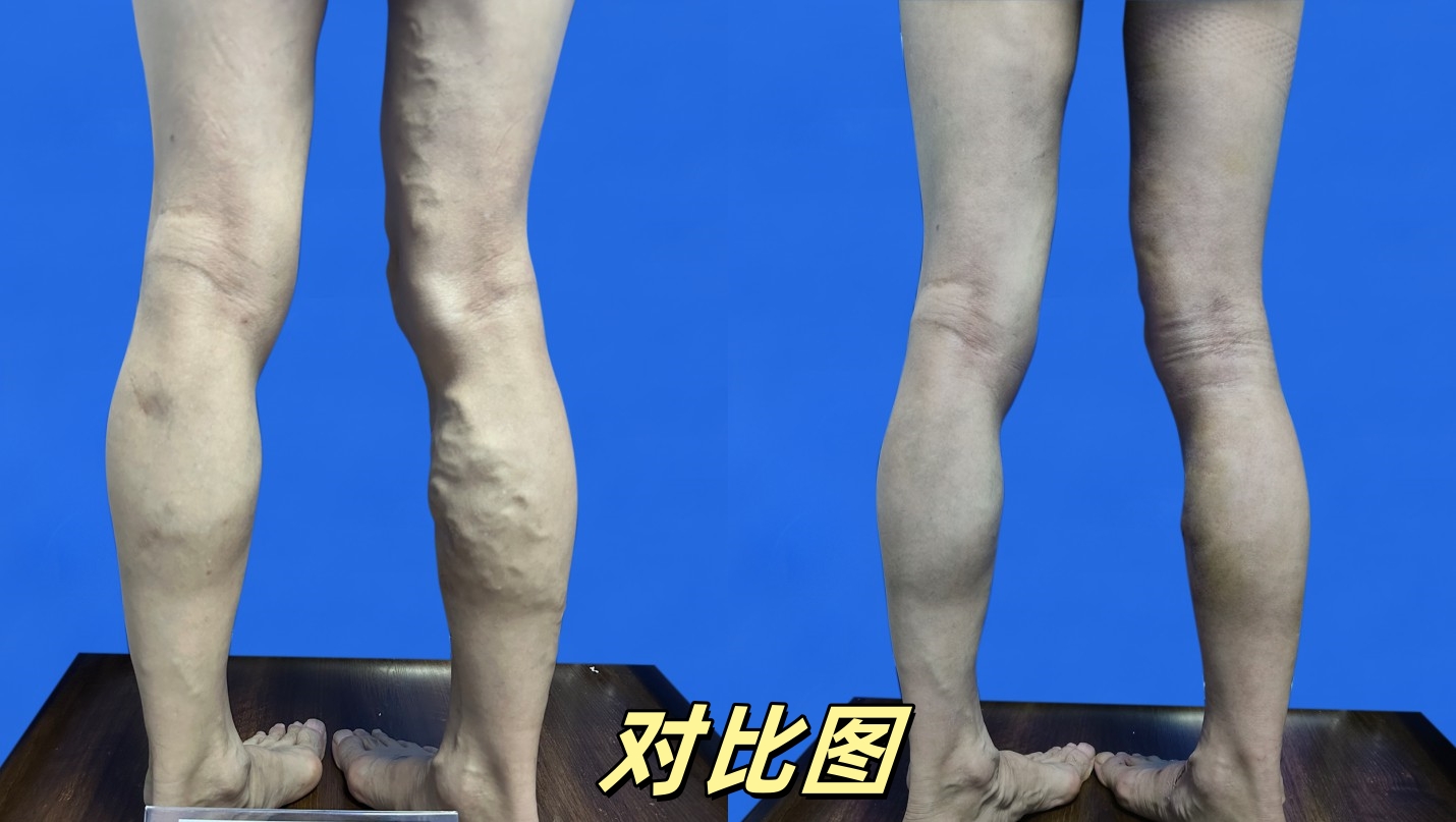 对比图11