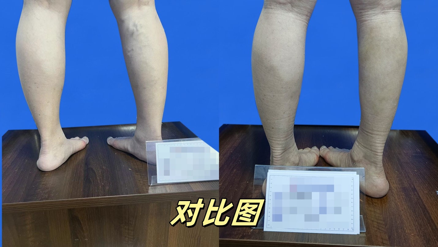 对比图08