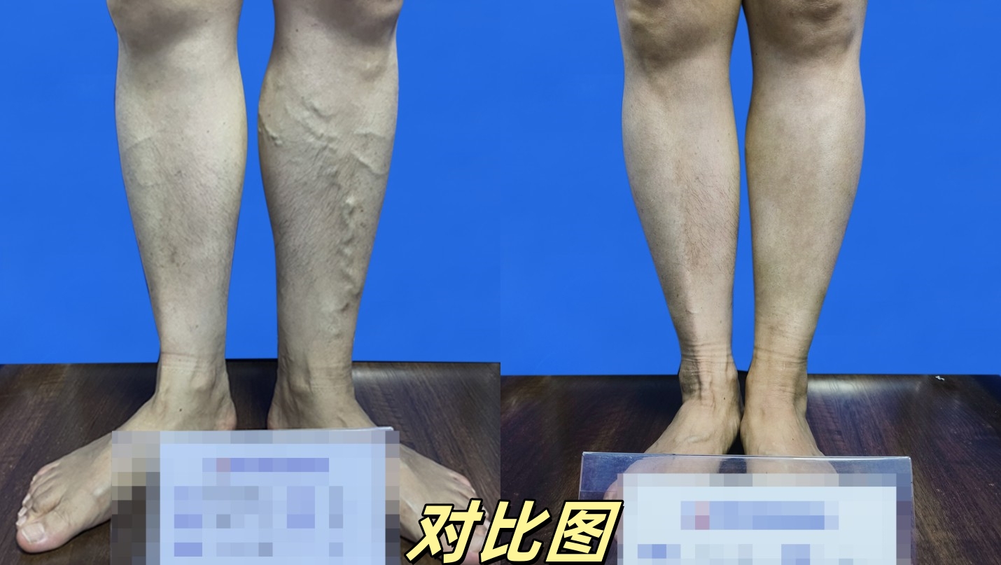 对比图02